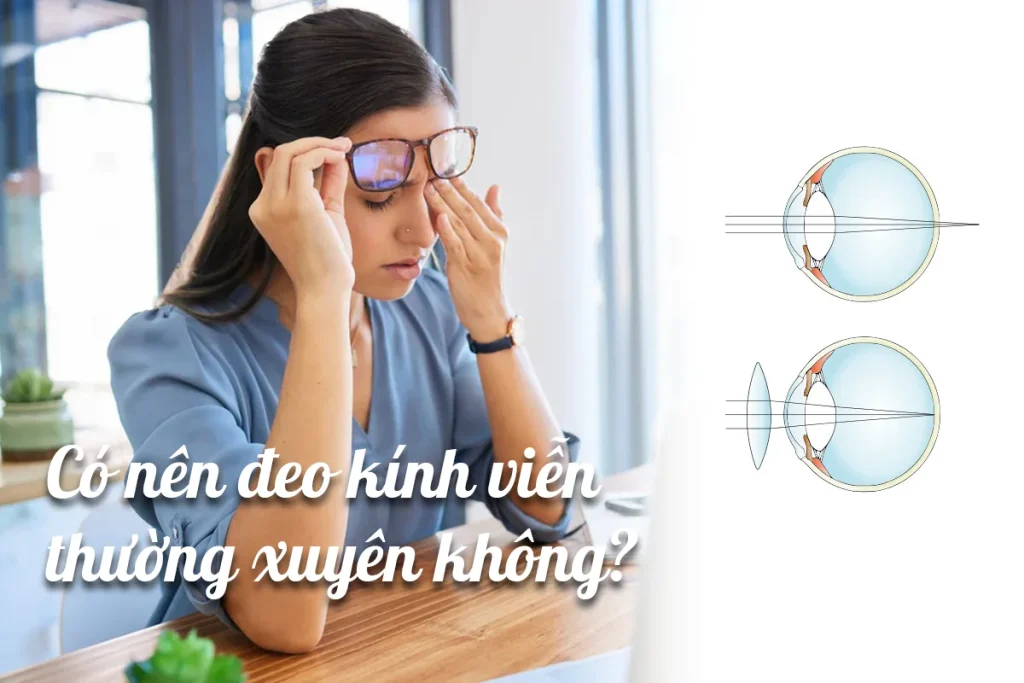 bị viễn thị có nên đeo kính