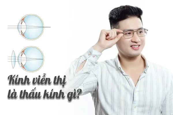 kính viễn thị là thấu kính gì